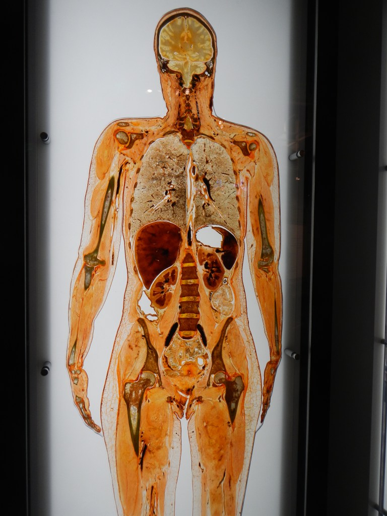 Freeze Dried Slice of a Human Female