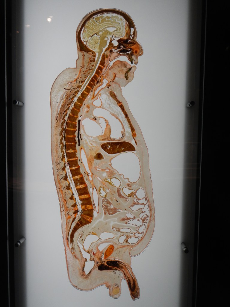 Freeze Dried Slice of a Human Male